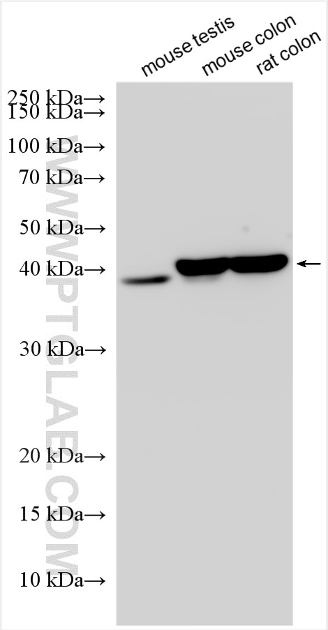 Western Blot (WB) analysis of various lysates using ADH1C Polyclonal antibody (30621-1-AP)