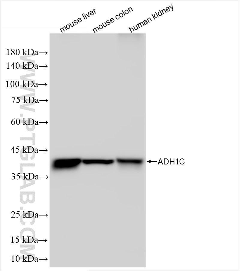 Western Blot (WB) analysis of various lysates using ADH1C Recombinant antibody (84546-2-RR)