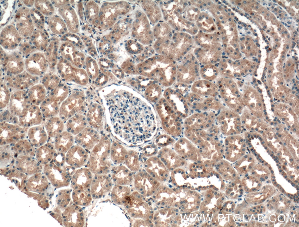 IHC staining of human kidney using 16474-1-AP