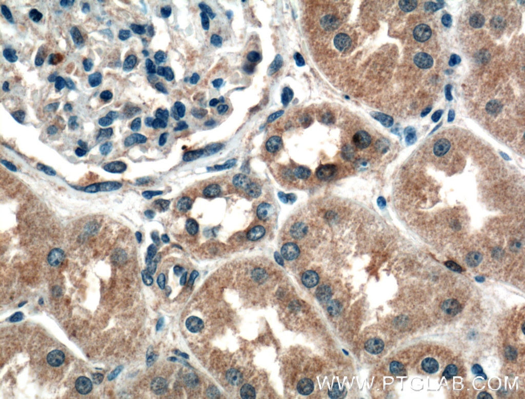 Immunohistochemistry (IHC) staining of human kidney tissue using ADH4 Polyclonal antibody (16474-1-AP)