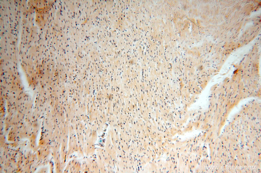 IHC staining of human heart using 16474-1-AP