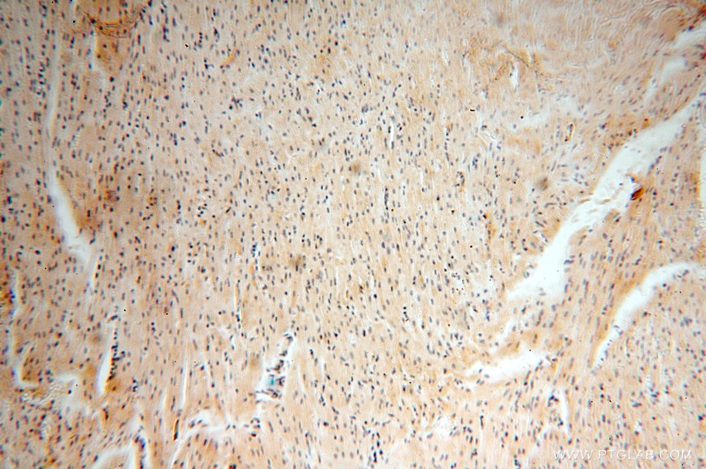 Immunohistochemistry (IHC) staining of human heart tissue using ADH4 Polyclonal antibody (16474-1-AP)