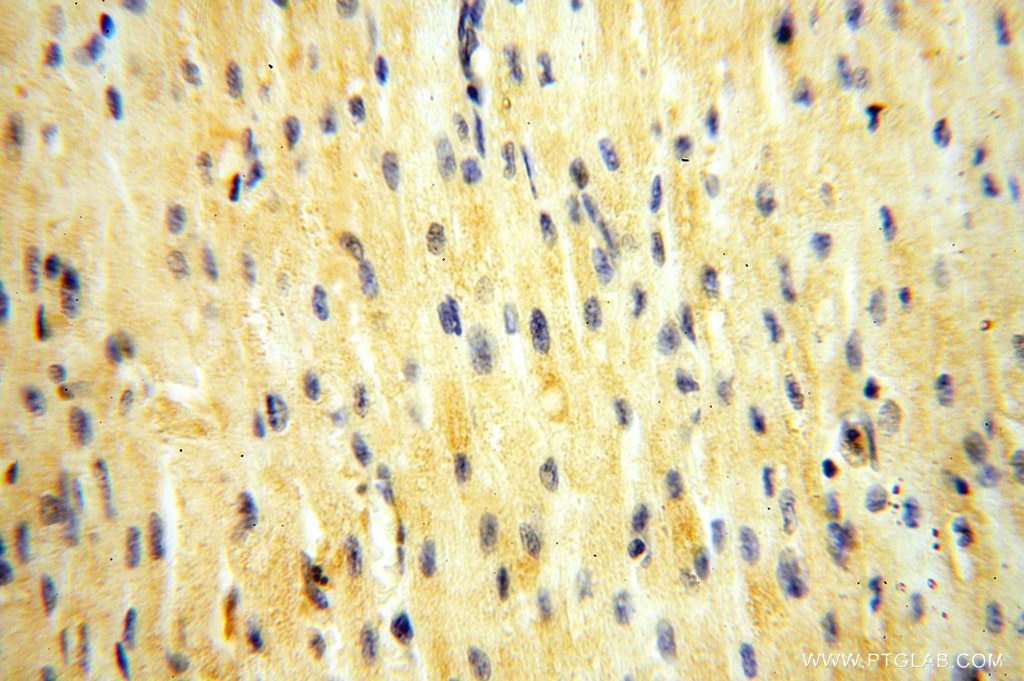 Immunohistochemistry (IHC) staining of human heart tissue using ADH4 Polyclonal antibody (16474-1-AP)