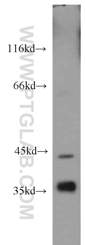 Western Blot (WB) analysis of mouse brain tissue using ADH4 Polyclonal antibody (16474-1-AP)