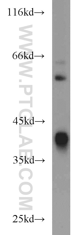 ADH4 Polyclonal antibody