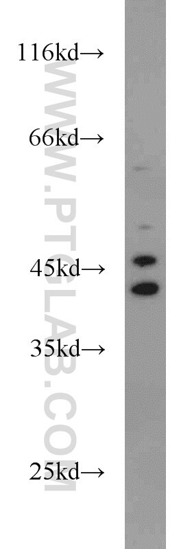 Western Blot (WB) analysis of HeLa cells using ADH4 Polyclonal antibody (16474-1-AP)