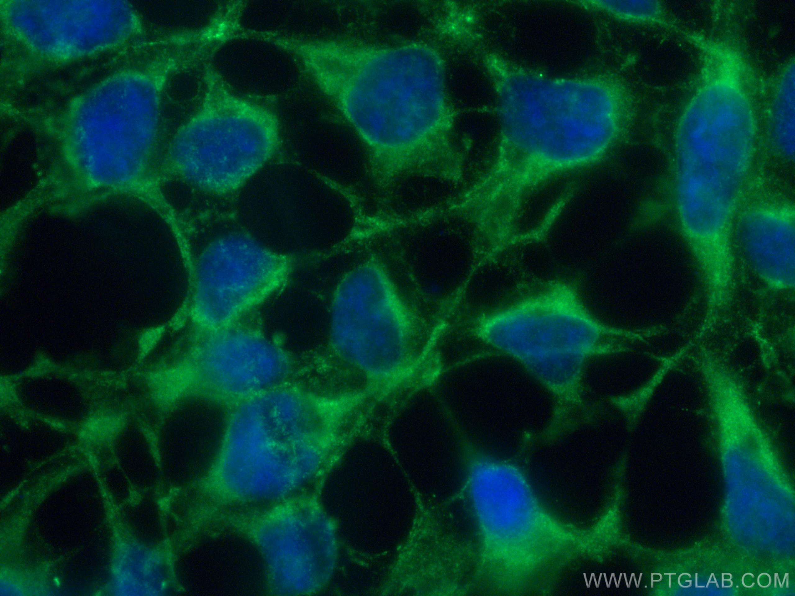 Immunofluorescence (IF) / fluorescent staining of HEK-293 cells using ADH4 Monoclonal antibody (67303-1-Ig)