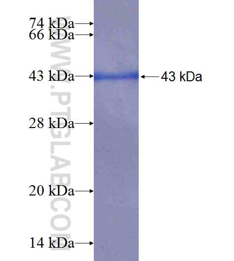 ADH4 fusion protein Ag9884 SDS-PAGE