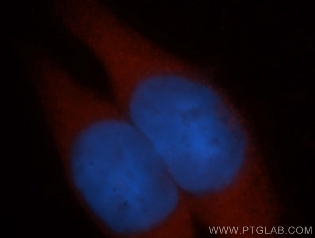 Immunofluorescence (IF) / fluorescent staining of MCF-7 cells using ADH6 Polyclonal antibody (13288-2-AP)