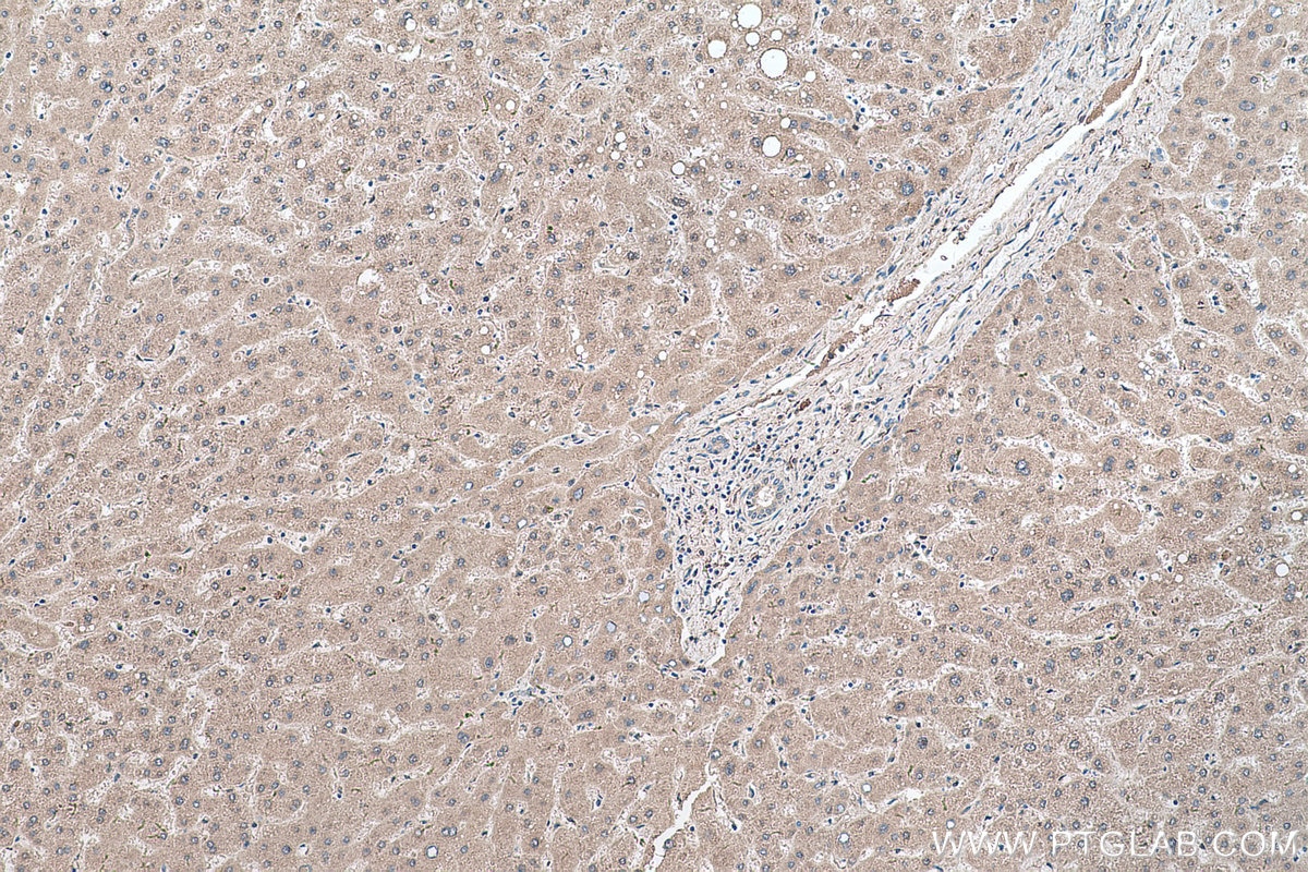 Immunohistochemistry (IHC) staining of human liver tissue using ADH6 Polyclonal antibody (13288-2-AP)