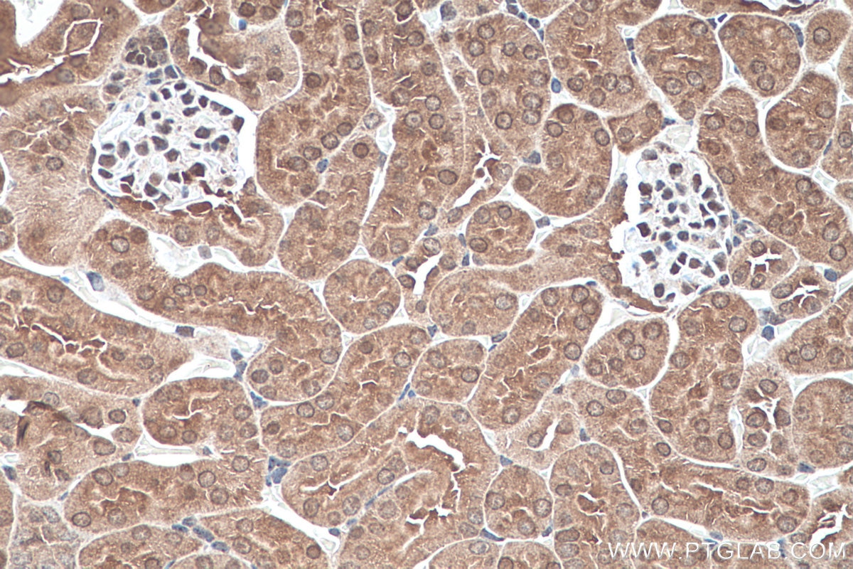 Immunohistochemistry (IHC) staining of mouse kidney tissue using ADH6 Polyclonal antibody (13288-2-AP)