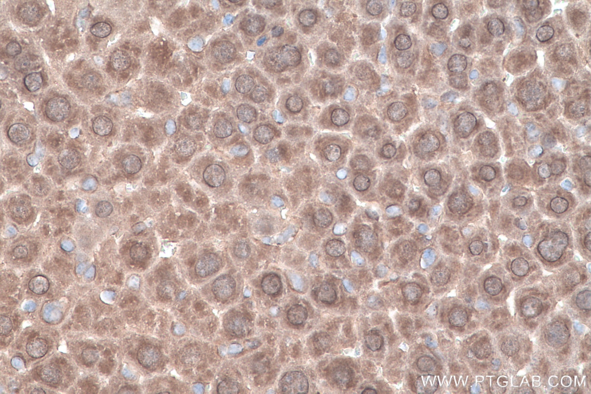 Immunohistochemistry (IHC) staining of mouse liver tissue using ADH6 Polyclonal antibody (13288-2-AP)