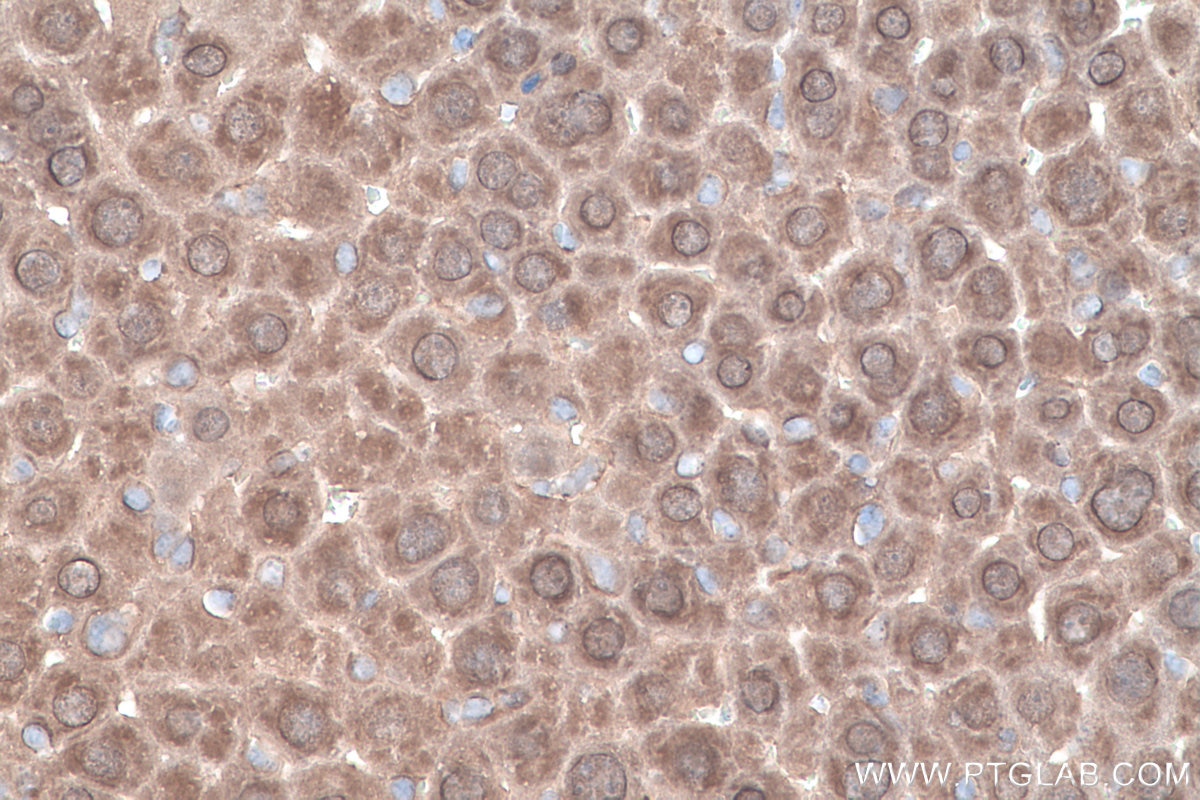 IHC staining of mouse liver using 13288-2-AP