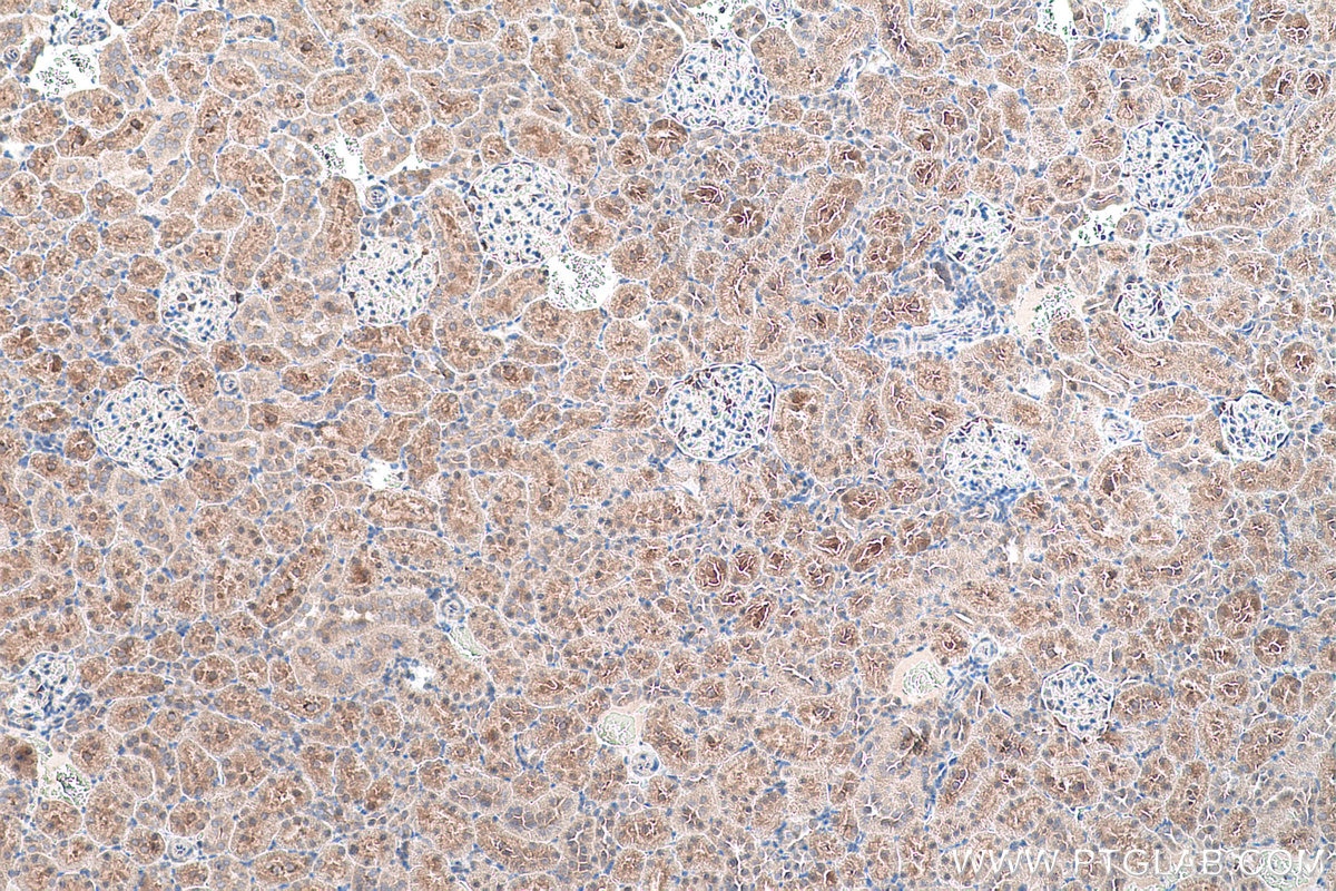 Immunohistochemistry (IHC) staining of rat kidney tissue using ADH6 Polyclonal antibody (13288-2-AP)