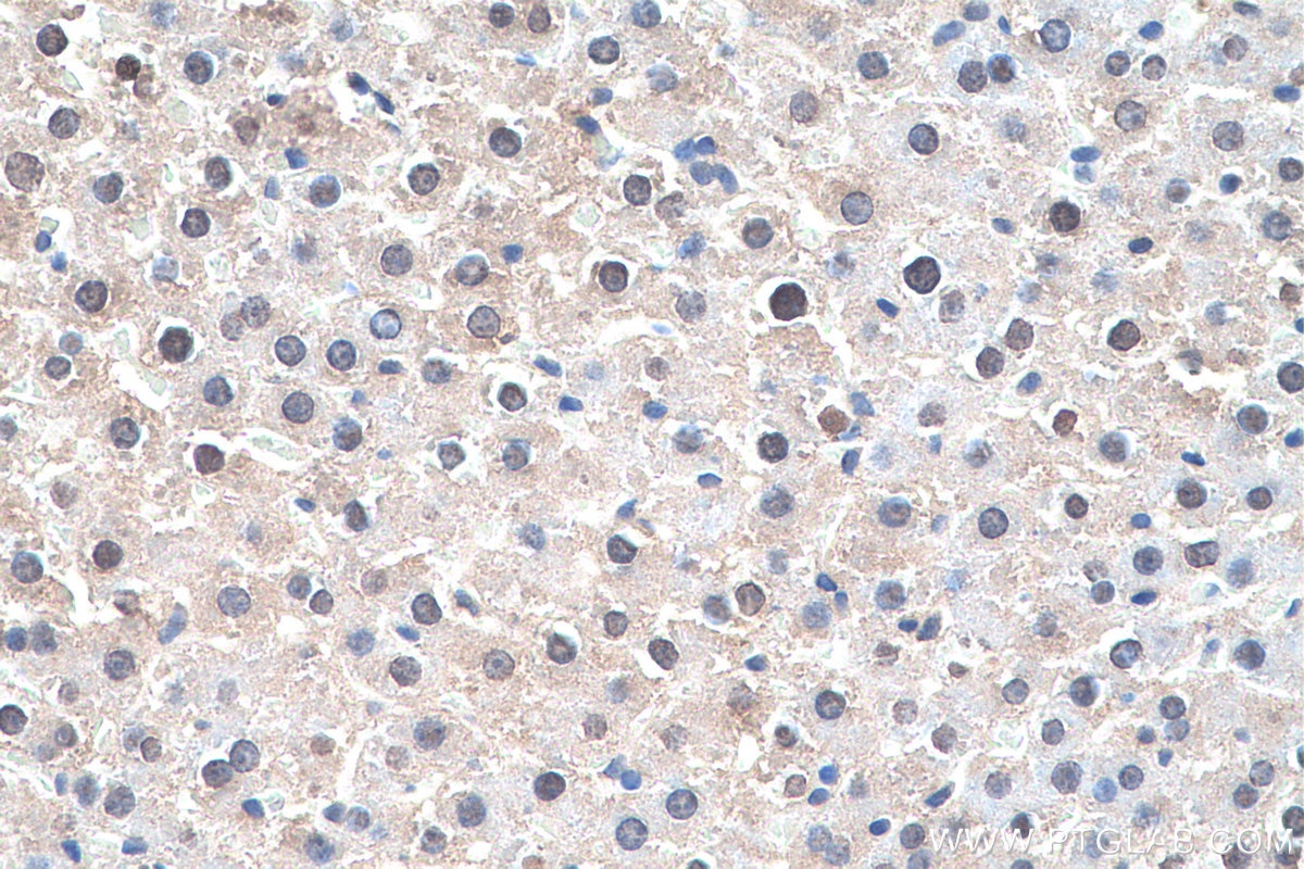 Immunohistochemistry (IHC) staining of rat liver tissue using ADH6 Polyclonal antibody (13288-2-AP)