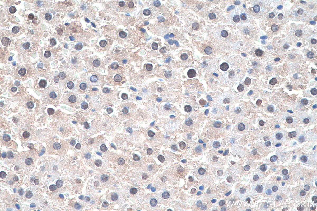 IHC staining of rat liver using 13288-2-AP