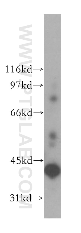 Western Blot (WB) analysis of human liver tissue using ADH6 Polyclonal antibody (13288-2-AP)