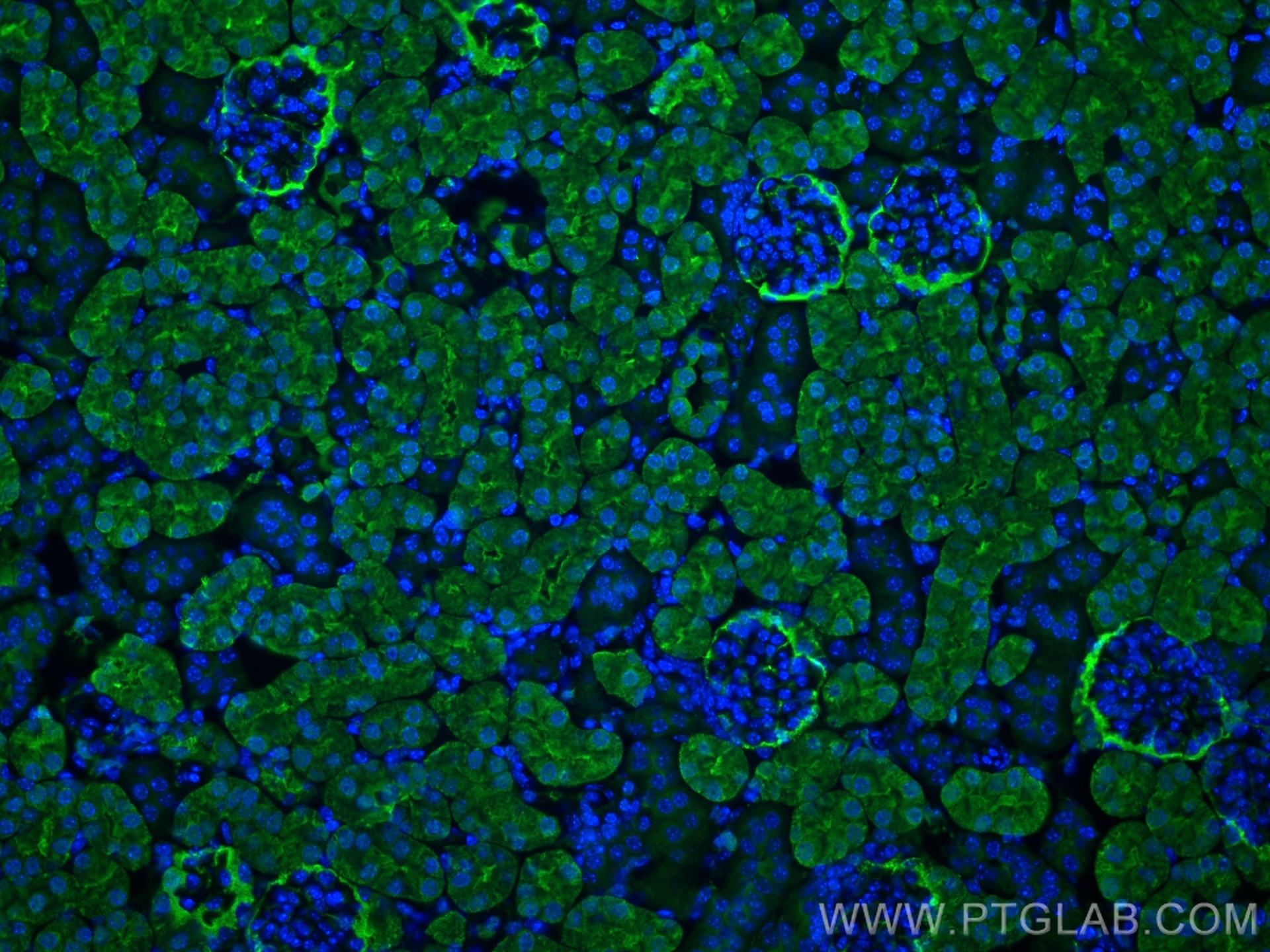Immunofluorescence (IF) / fluorescent staining of mouse kidney tissue using ADH6 Monoclonal antibody (67709-1-Ig)