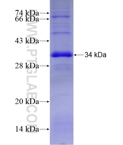 ADH6 fusion protein Ag28845 SDS-PAGE