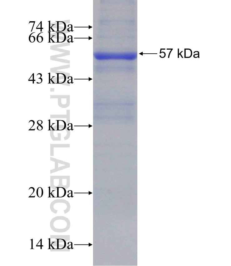 ADH6 fusion protein Ag3984 SDS-PAGE