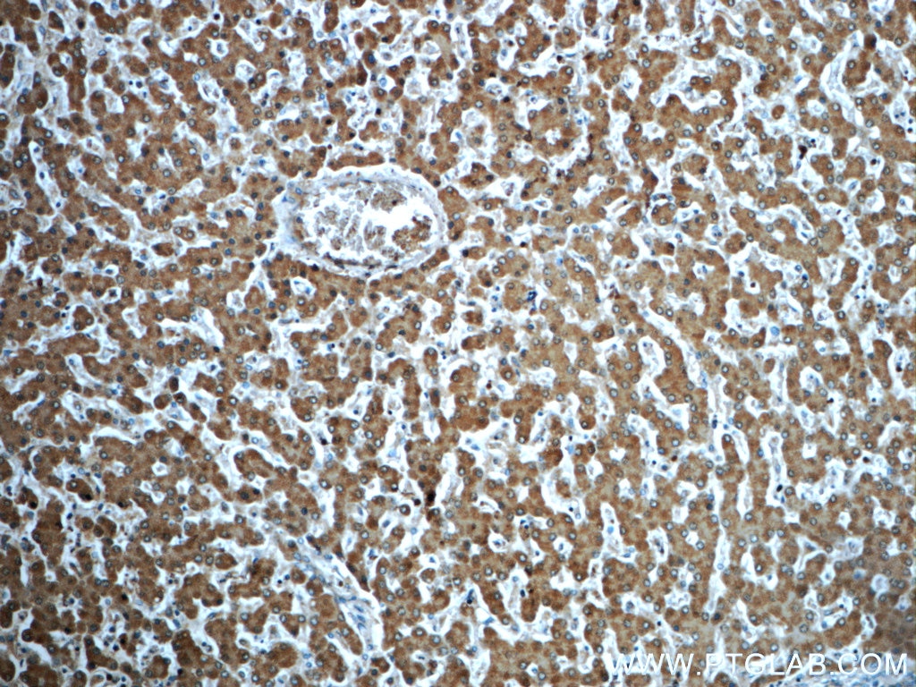 Immunohistochemistry (IHC) staining of human liver tissue using ADH7 Polyclonal antibody (23425-1-AP)