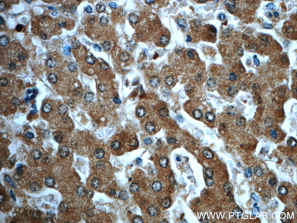 Immunohistochemistry (IHC) staining of human liver tissue using ADH7 Polyclonal antibody (23425-1-AP)
