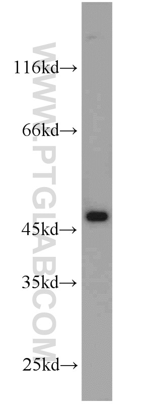 Western Blot (WB) analysis of HeLa cells using ADH7 Polyclonal antibody (23425-1-AP)