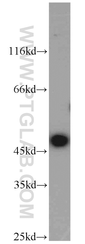 Western Blot (WB) analysis of HEK-293 cells using ADH7 Polyclonal antibody (23425-1-AP)