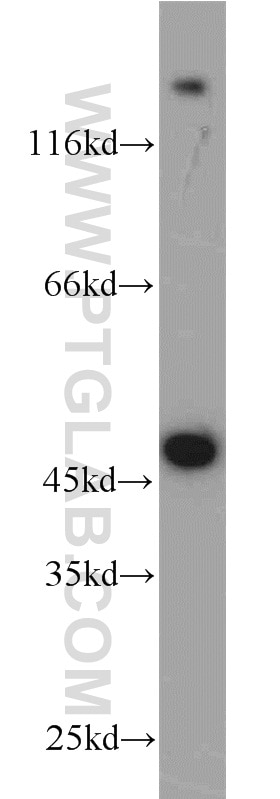 Western Blot (WB) analysis of A549 cells using ADH7 Polyclonal antibody (23425-1-AP)