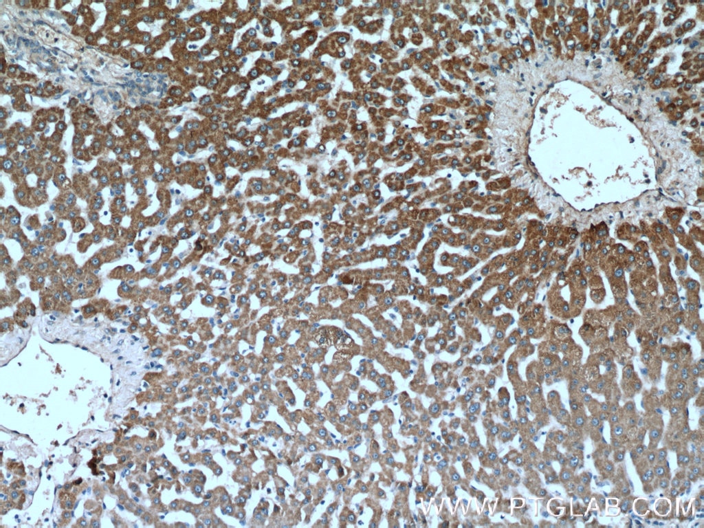 Immunohistochemistry (IHC) staining of human liver tissue using ADHFE1 Polyclonal antibody (14674-1-AP)