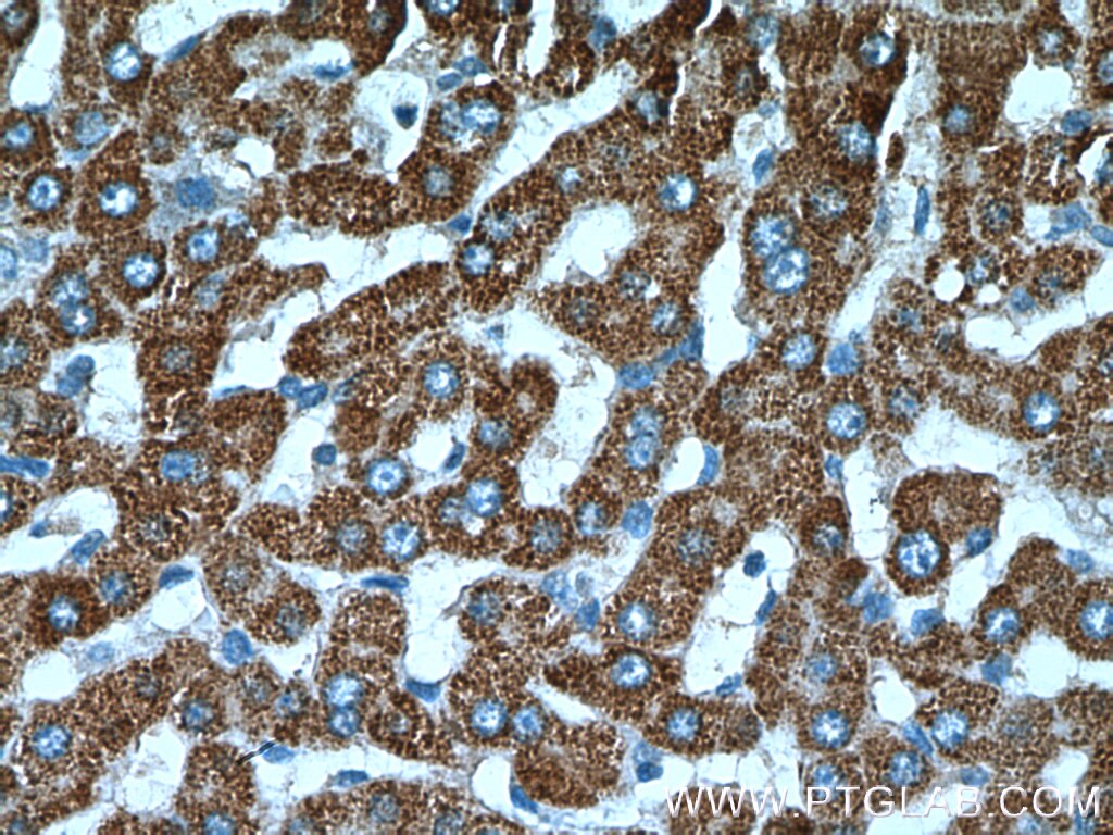 Immunohistochemistry (IHC) staining of human liver tissue using ADHFE1 Polyclonal antibody (14674-1-AP)