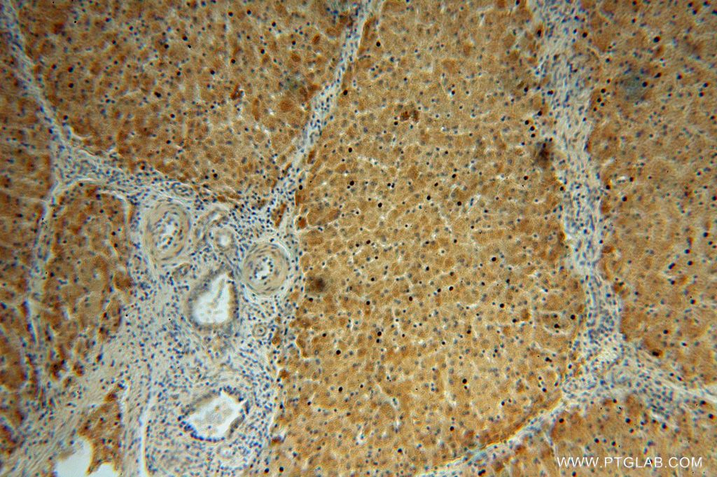 Immunohistochemistry (IHC) staining of human liver tissue using ADHFE1 Polyclonal antibody (14674-1-AP)