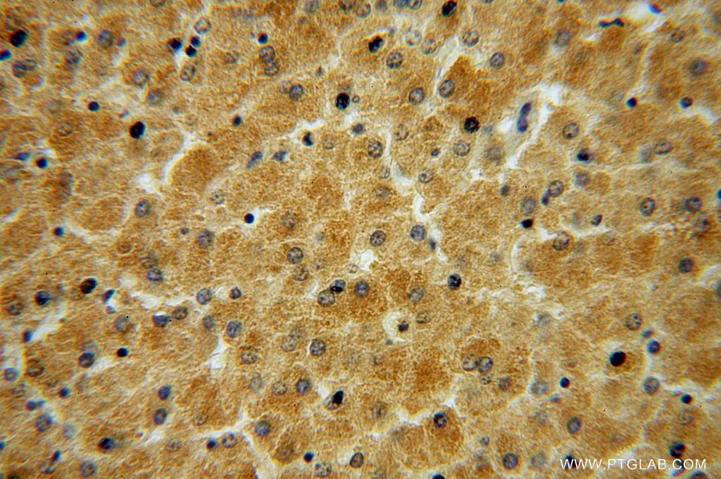 Immunohistochemistry (IHC) staining of human liver tissue using ADHFE1 Polyclonal antibody (14674-1-AP)