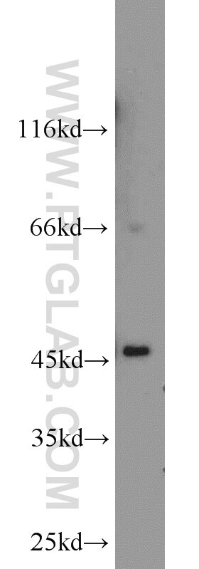 Western Blot (WB) analysis of rat kidney tissue using ADHFE1 Polyclonal antibody (14674-1-AP)