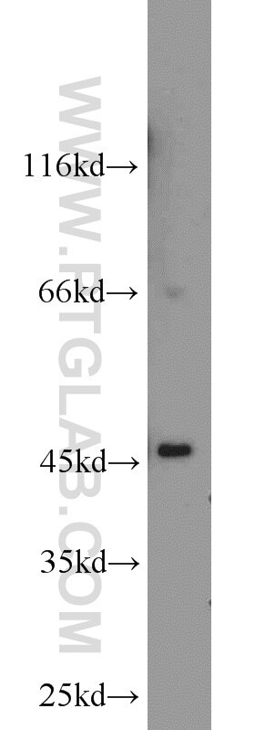 WB analysis of rat kidney using 14674-1-AP