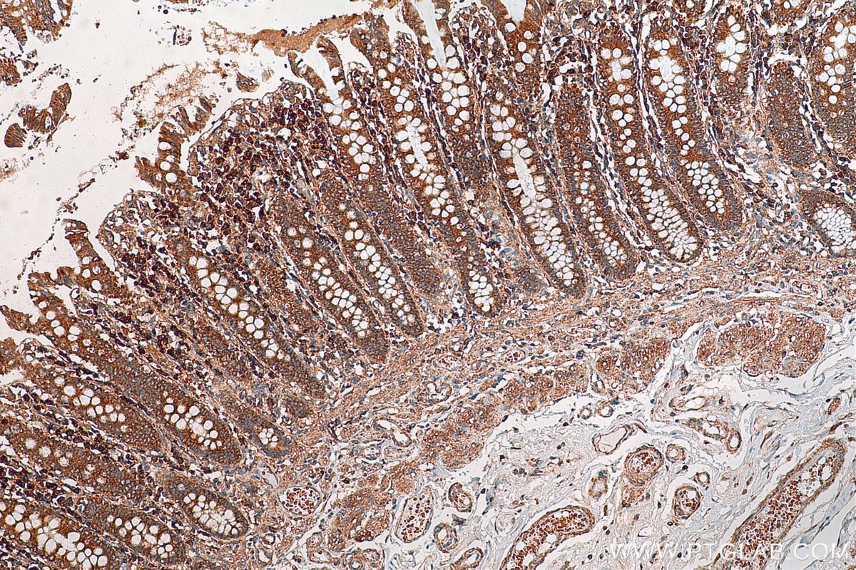 Immunohistochemistry (IHC) staining of human colon tissue using ADHFE1 Polyclonal antibody (19359-1-AP)