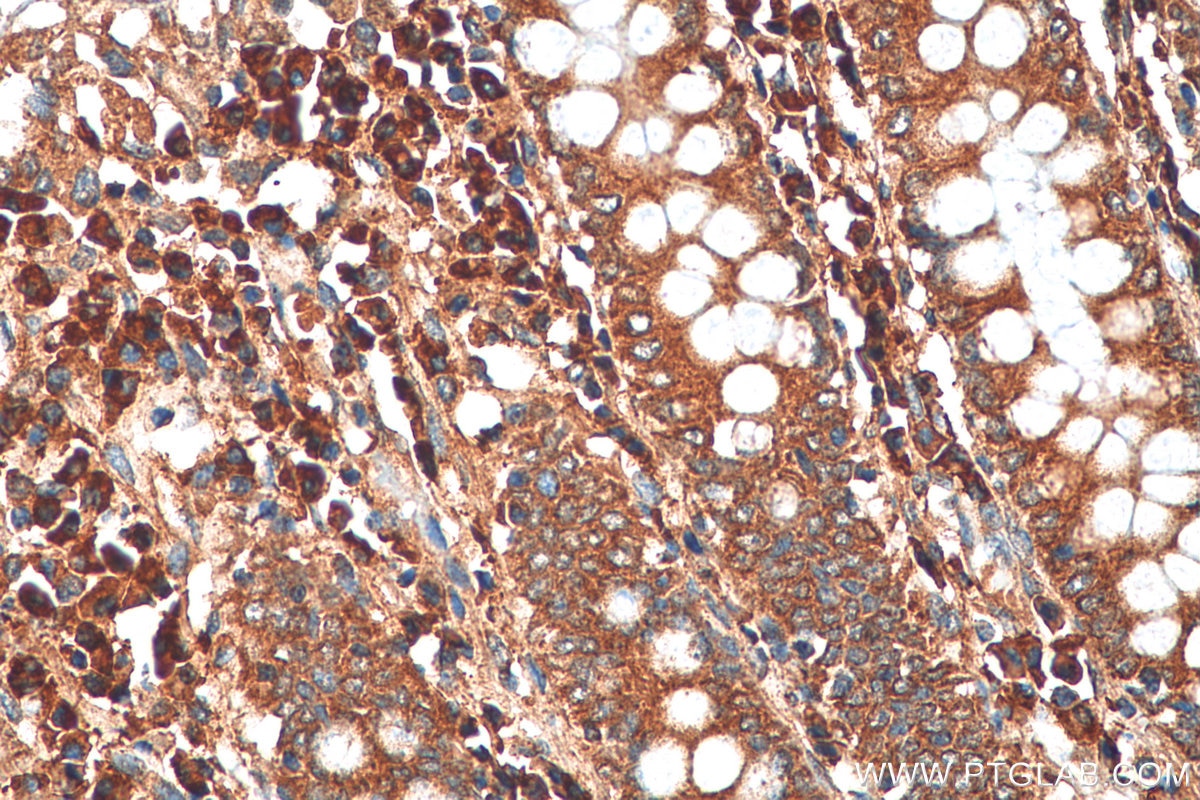 Immunohistochemistry (IHC) staining of human colon tissue using ADHFE1 Polyclonal antibody (19359-1-AP)