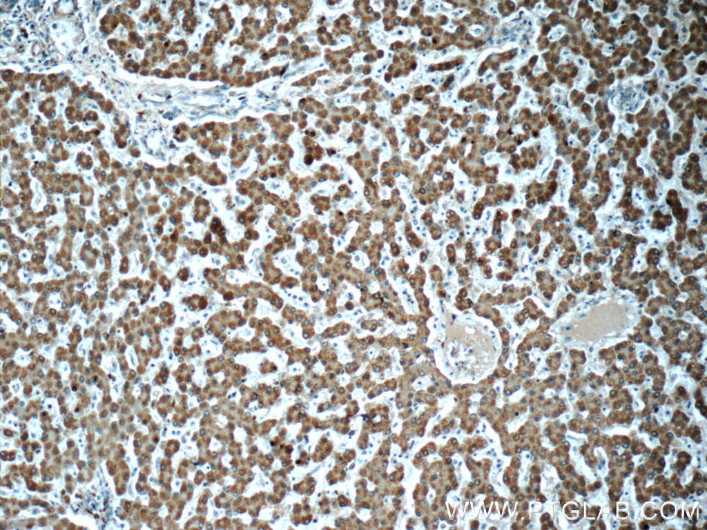 IHC staining of human liver using 19359-1-AP