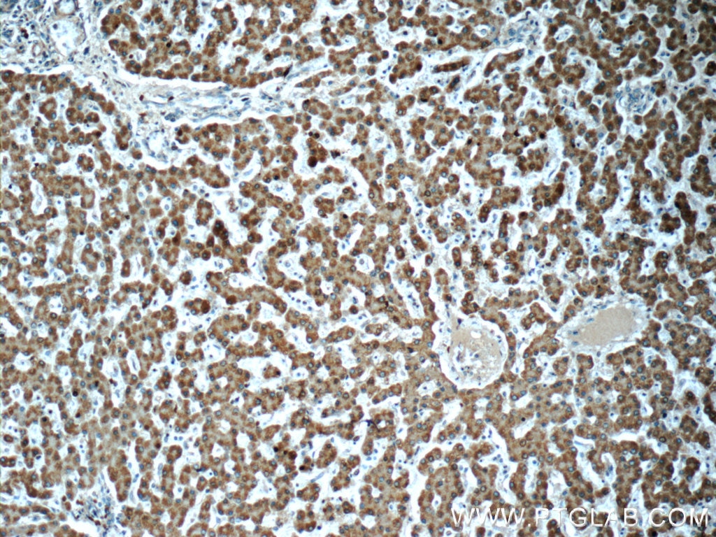 Immunohistochemistry (IHC) staining of human liver tissue using ADHFE1 Polyclonal antibody (19359-1-AP)