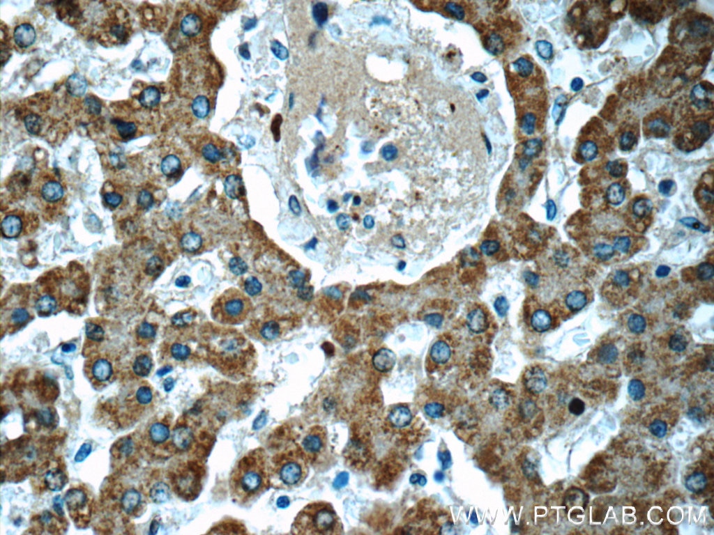 Immunohistochemistry (IHC) staining of human liver tissue using ADHFE1 Polyclonal antibody (19359-1-AP)