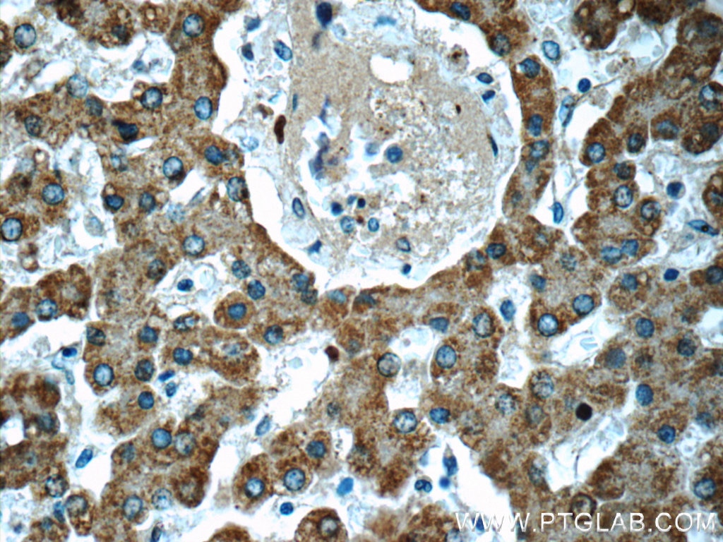 IHC staining of human liver using 19359-1-AP