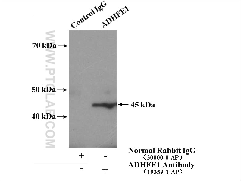 Immunoprecipitation (IP) experiment of mouse heart tissue using ADHFE1 Polyclonal antibody (19359-1-AP)