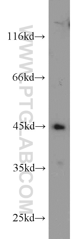 Western Blot (WB) analysis of mouse heart tissue using ADHFE1 Polyclonal antibody (19359-1-AP)