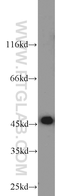 Western Blot (WB) analysis of rat kidney tissue using ADHFE1 Polyclonal antibody (19359-1-AP)