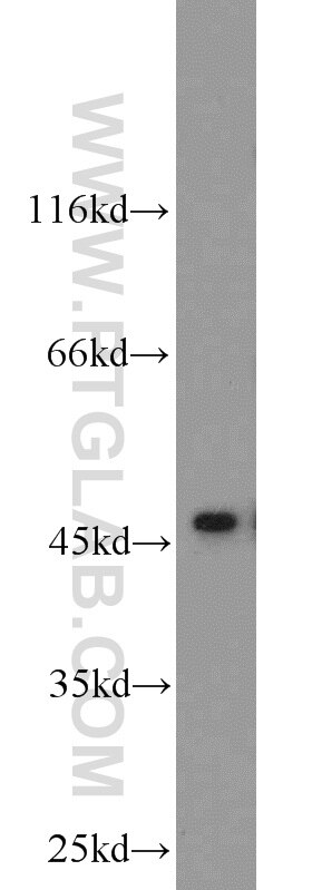 Western Blot (WB) analysis of mouse kidney tissue using ADHFE1 Polyclonal antibody (19359-1-AP)