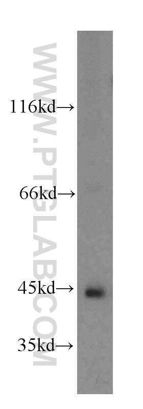 Western Blot (WB) analysis of mouse kidney tissue using ADHFE1 Polyclonal antibody (19359-1-AP)