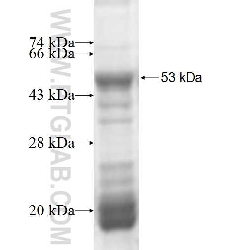 ADHFE1 fusion protein Ag6382 SDS-PAGE