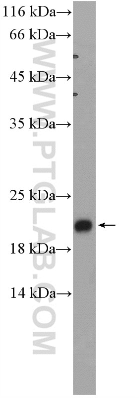 WB analysis of rat colon using 15133-1-AP