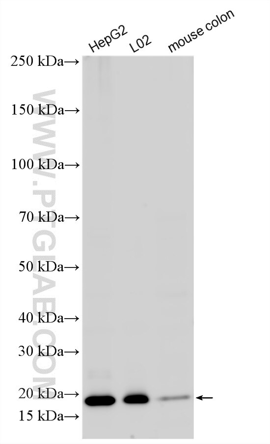 Western Blot (WB) analysis of various lysates using ADI1 Polyclonal antibody (15133-1-AP)