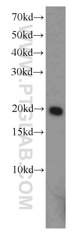 Western Blot (WB) analysis of human testis tissue using ADI1 Polyclonal antibody (15133-1-AP)